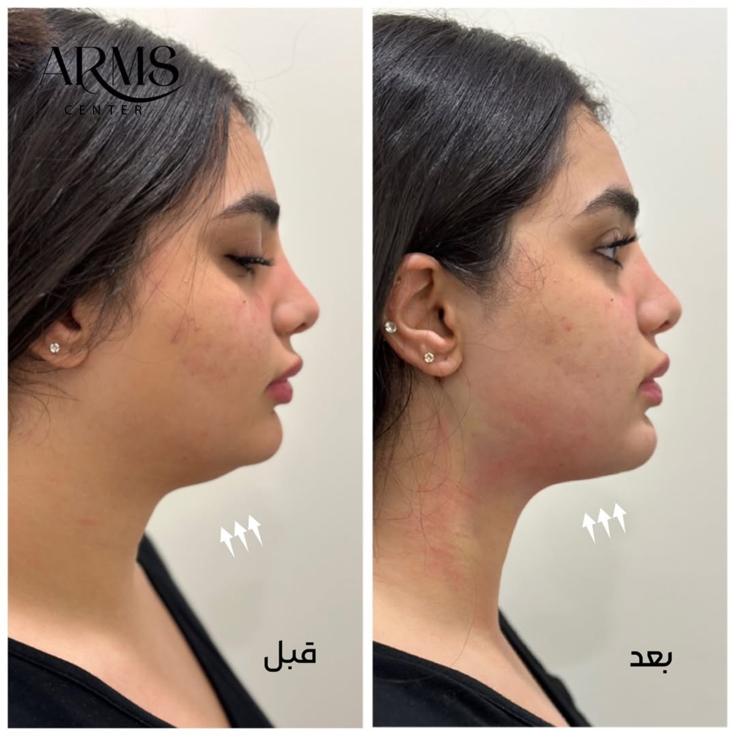 {"pictureId":"0838C435-CE08-4C51-B8ED-8CD477742CA2","source_type":"vicut","data":{},"tiktok_developers_3p_anchor_params":"{"source_type":"vicut","picture_template_id":"","client_key":"aw889s25wozf8s7e"}"}