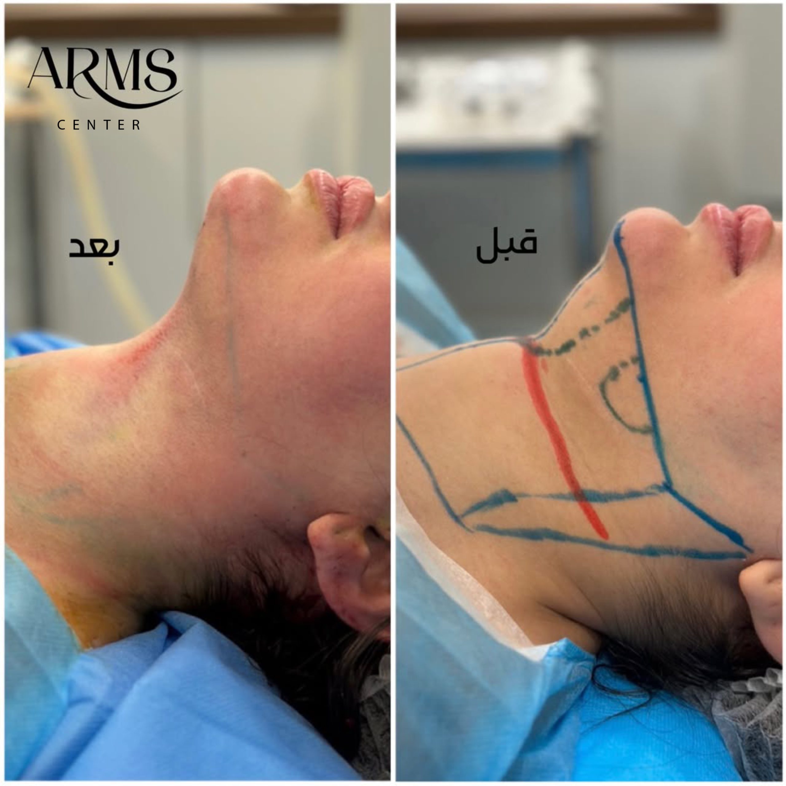 {"data":{},"pictureId":"260B01D8-7BA0-4E30-A325-F7CF394C44C2","source_type":"vicut","tiktok_developers_3p_anchor_params":"{"picture_template_id":"","source_type":"vicut","client_key":"aw889s25wozf8s7e"}"}