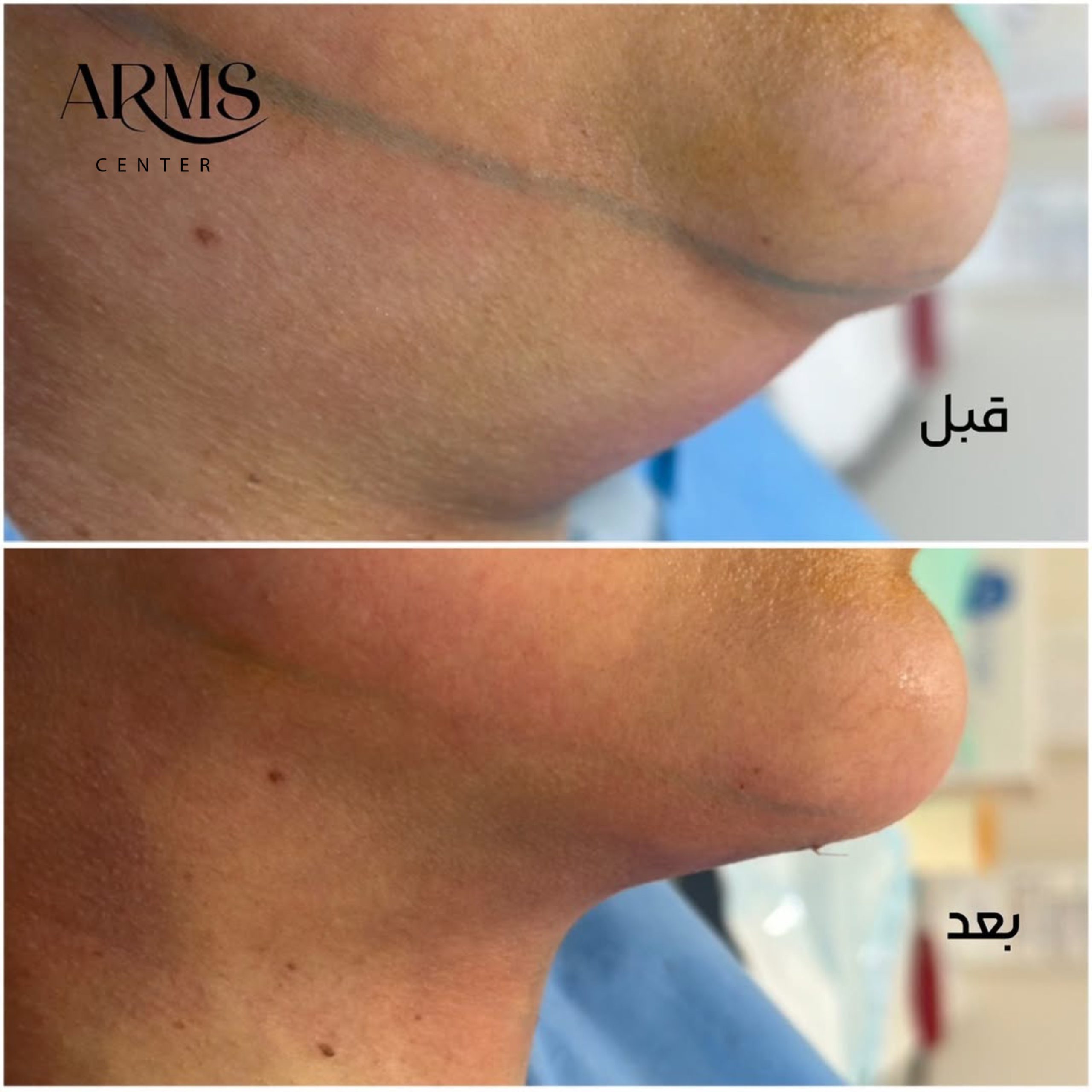 {"data":{},"source_type":"vicut","tiktok_developers_3p_anchor_params":"{"source_type":"vicut","client_key":"aw889s25wozf8s7e","picture_template_id":""}","pictureId":"F83AD2B8-02AB-4F3B-99BF-C1A18C9F7840"}