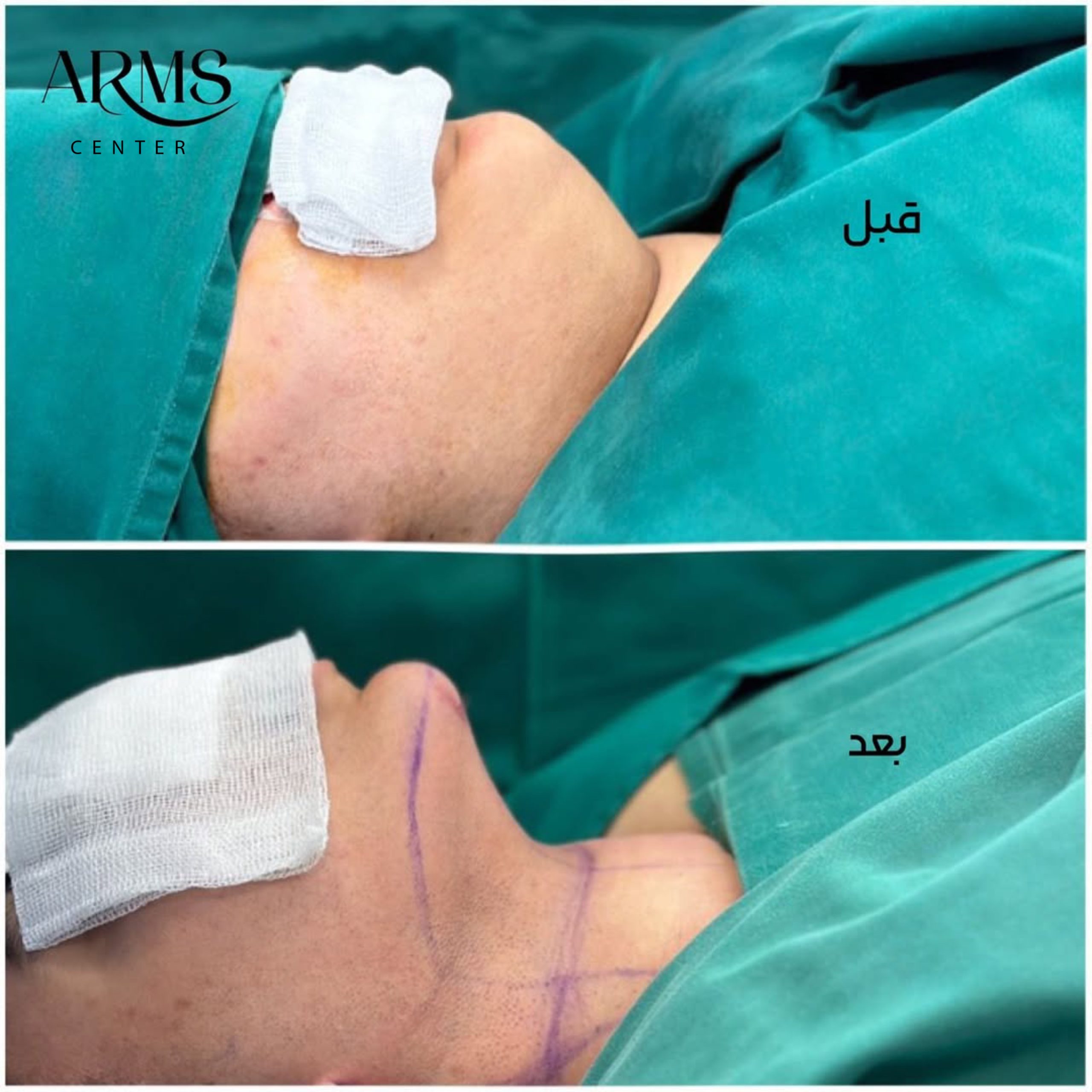 {"pictureId":"810C055D-42E6-4441-A7DE-3981EFB77E3E","tiktok_developers_3p_anchor_params":"{"client_key":"aw889s25wozf8s7e","source_type":"vicut","picture_template_id":""}","data":{},"source_type":"vicut"}