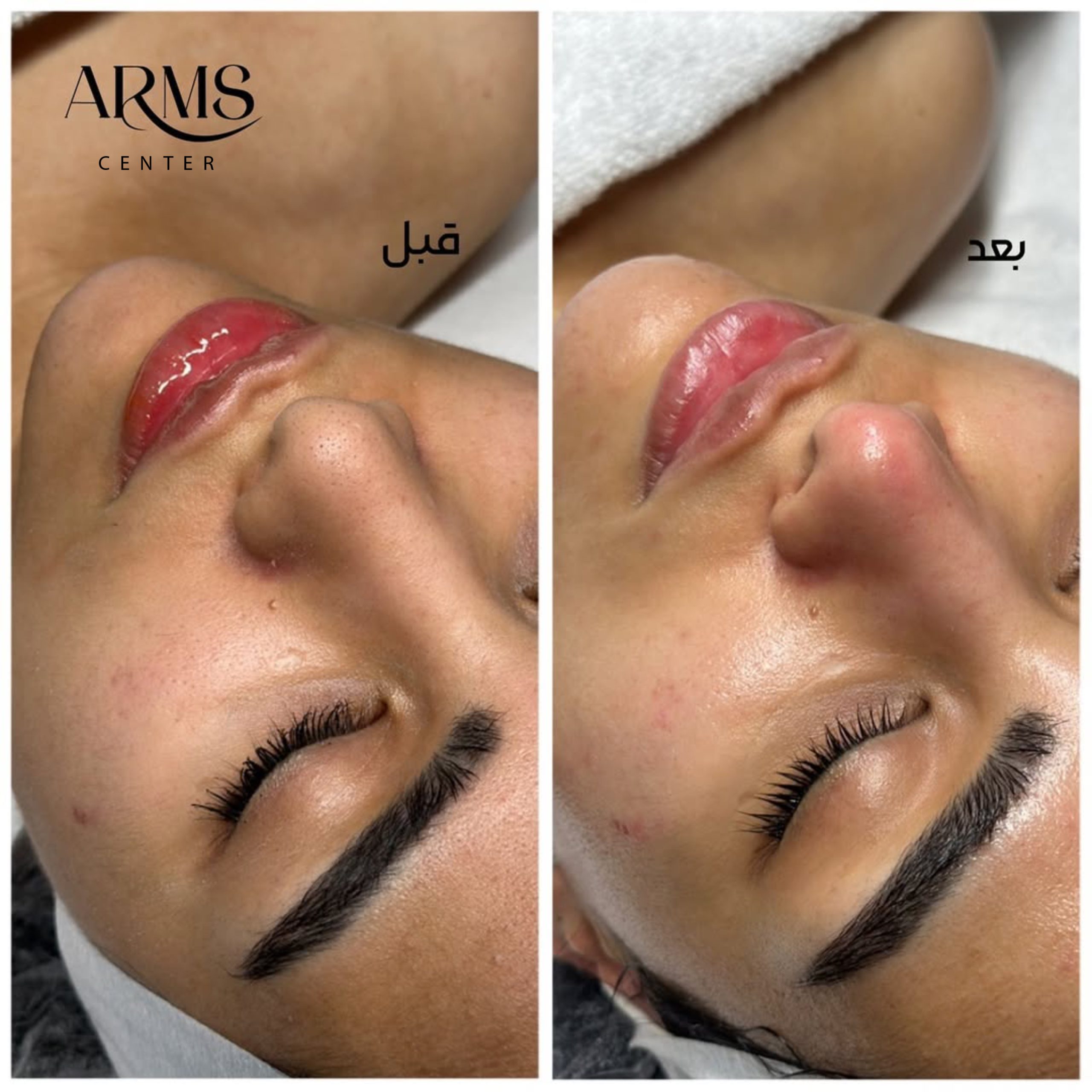 {"exportType":"image_export","tiktok_developers_3p_anchor_params":"{"client_key":"aw889s25wozf8s7e","picture_template_id":"","capability_name":"retouch_edit_tool","source_type":"vicut"}","pictureId":"282C10A7-EC1C-480D-839F-727D094E7D78","editType":"image_edit","source_type":"vicut","data":{}}