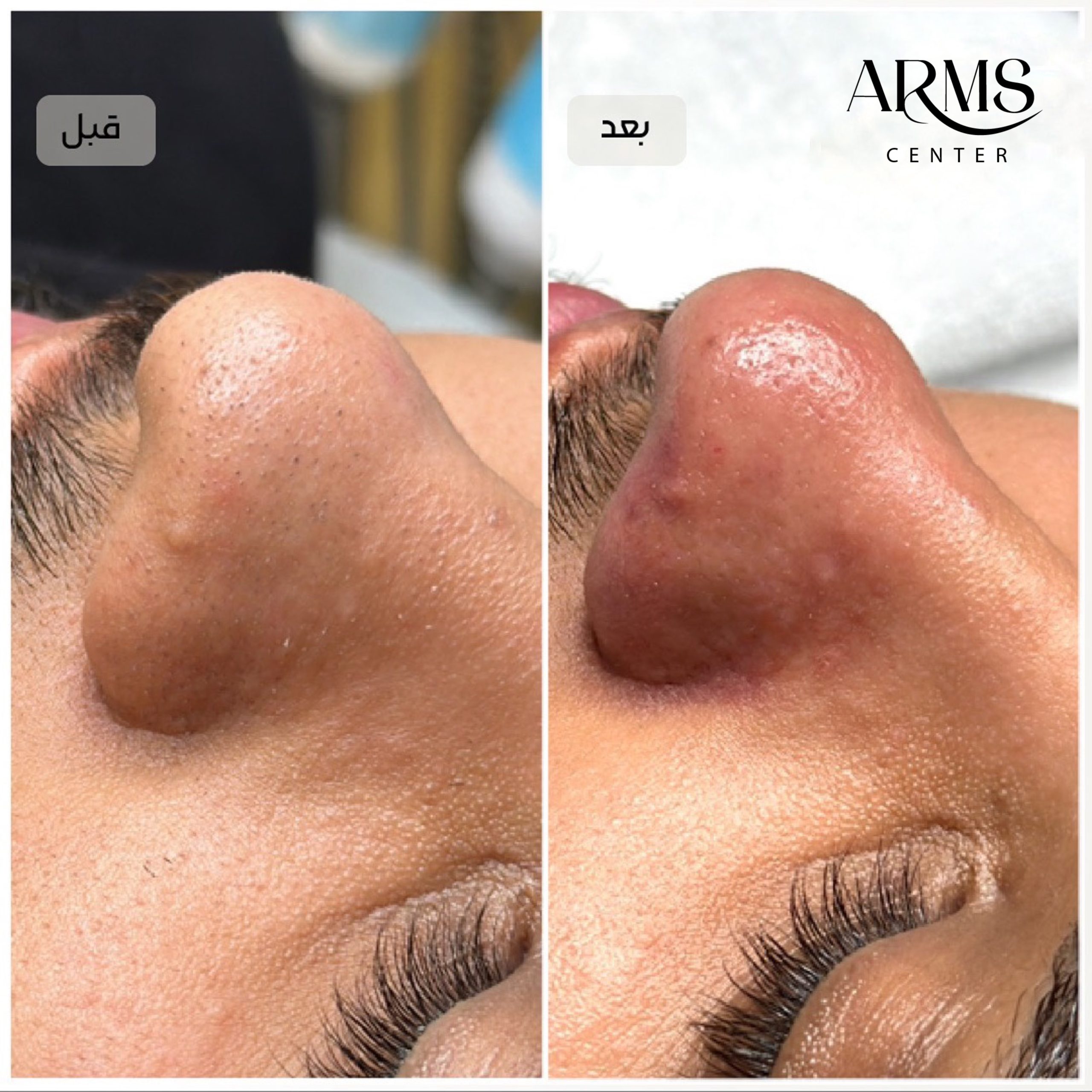 {"tiktok_developers_3p_anchor_params":"{"picture_template_id":"","client_key":"aw889s25wozf8s7e","capability_name":"retouch_edit_tool","source_type":"vicut"}","pictureId":"77CEBA4C-6FFD-489F-A98B-3F0C7A891B7C","editType":"image_edit","data":{},"exportType":"image_export","source_type":"vicut"}