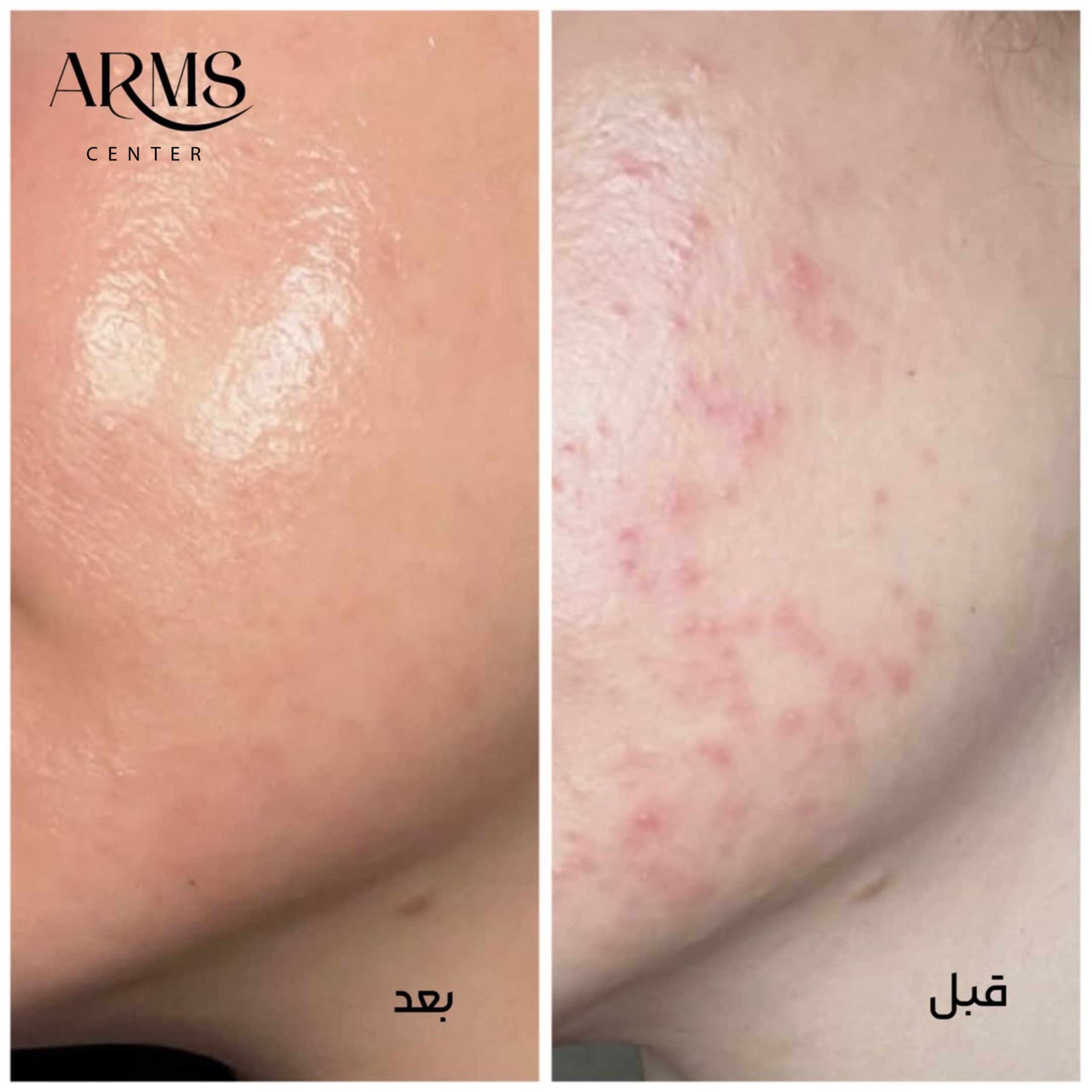 {"data":{},"exportType":"image_export","editType":"image_edit","source_type":"vicut","tiktok_developers_3p_anchor_params":"{"client_key":"aw889s25wozf8s7e","capability_name":"retouch_edit_tool","source_type":"vicut","picture_template_id":""}","pictureId":"EB64CA3A-B150-441F-AC6F-B2B199747079"}