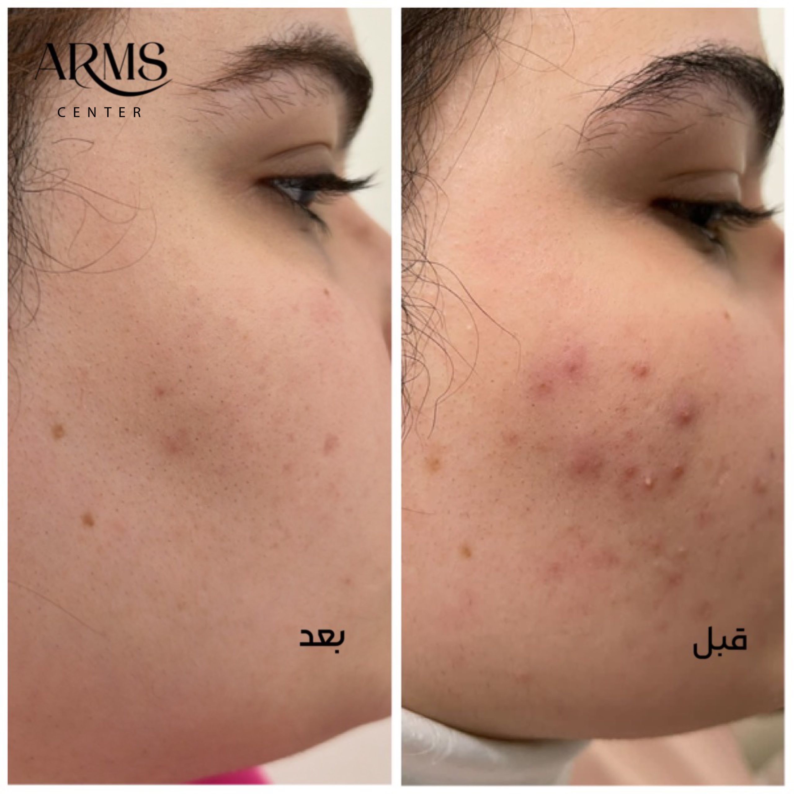 {"editType":"image_edit","data":{},"source_type":"vicut","tiktok_developers_3p_anchor_params":"{"capability_name":"retouch_edit_tool","source_type":"vicut","picture_template_id":"","client_key":"aw889s25wozf8s7e"}","exportType":"image_export","pictureId":"518FAFD6-FCBE-40B4-8714-93301D7FB174"}