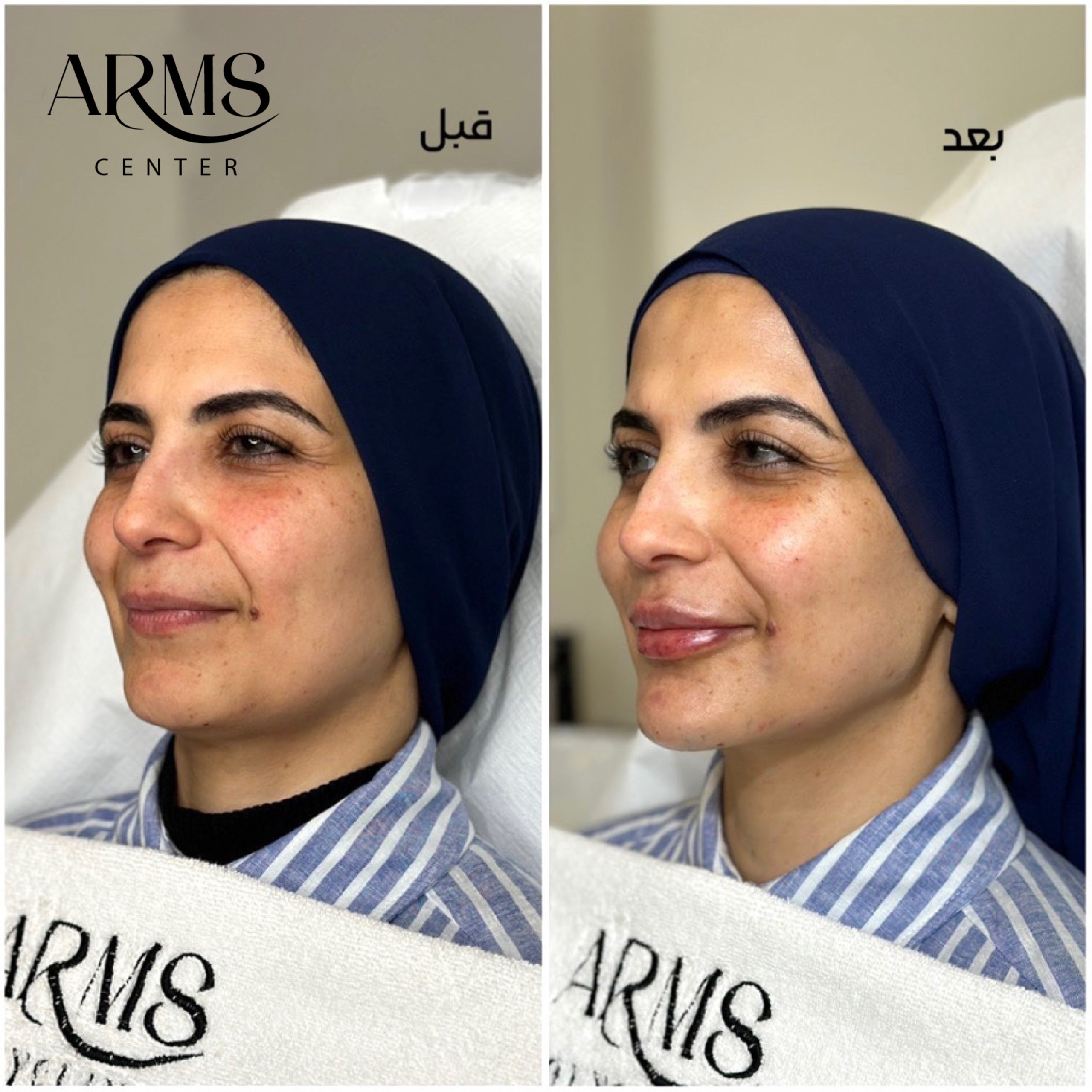 {"data":{},"pictureId":"FC468A56-7850-4BB8-A641-8AD7208E4F8E","source_type":"vicut","tiktok_developers_3p_anchor_params":"{"source_type":"vicut","picture_template_id":"","client_key":"aw889s25wozf8s7e"}"}