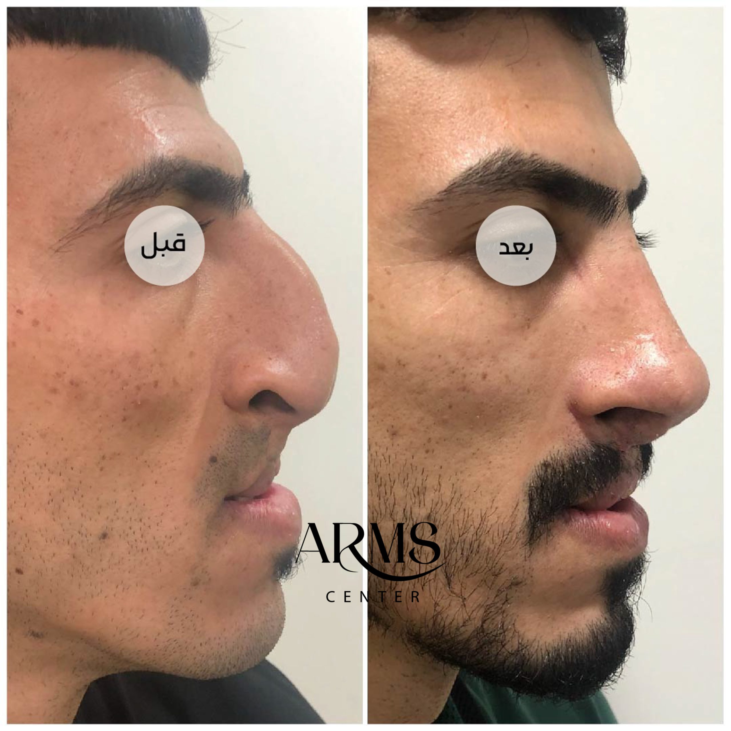 {"data":{},"editType":"image_edit","source_type":"vicut","tiktok_developers_3p_anchor_params":"{"source_type":"vicut","picture_template_id":"","client_key":"aw889s25wozf8s7e","capability_name":"retouch_edit_tool"}","exportType":"image_export","pictureId":"DFF25C8C-9476-40A0-B75A-87458B7B05C3"}