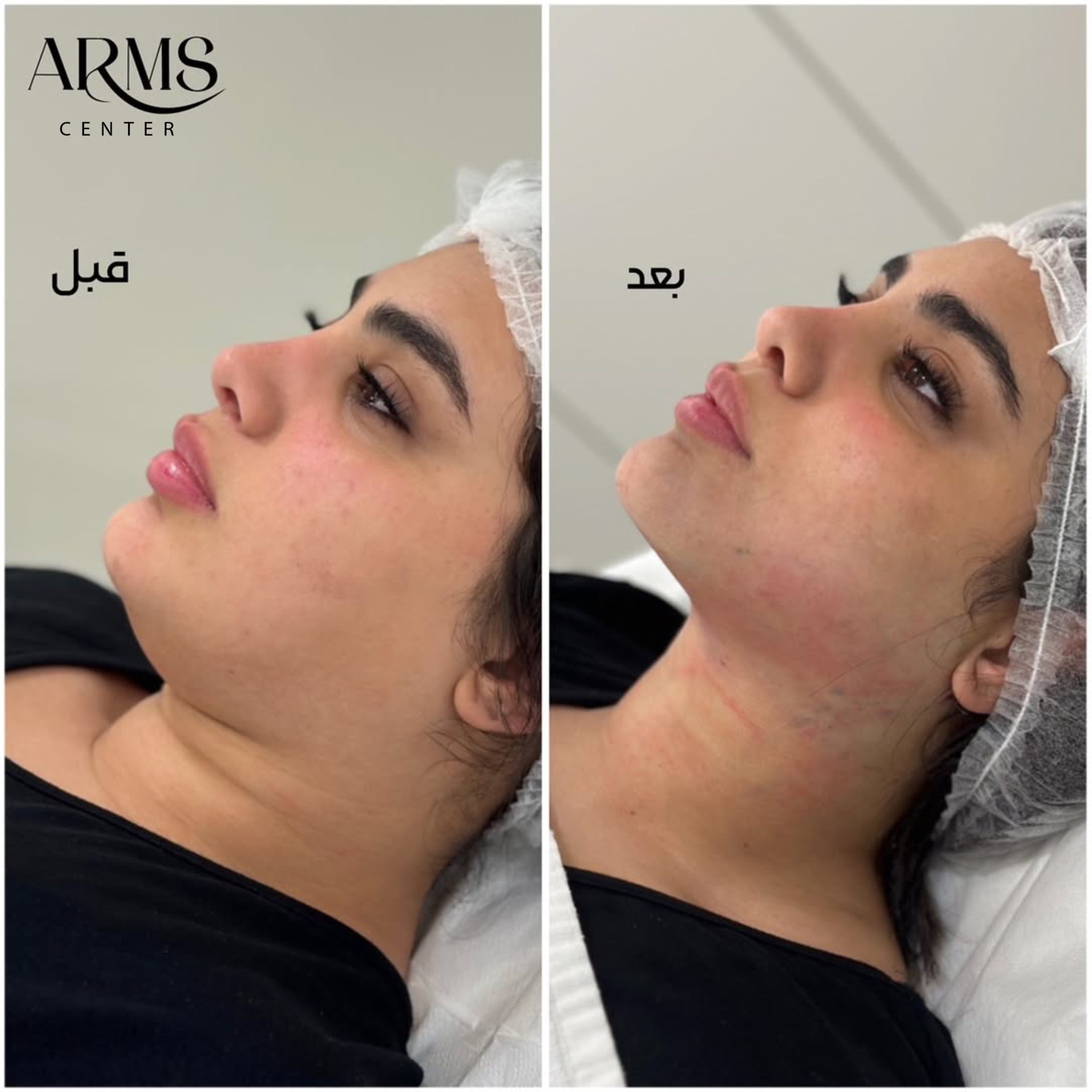 {"source_type":"vicut","pictureId":"75B68A9C-A167-4CBA-8C87-5B8BABDD1DDE","data":{},"tiktok_developers_3p_anchor_params":"{"client_key":"aw889s25wozf8s7e","source_type":"vicut","picture_template_id":""}"}