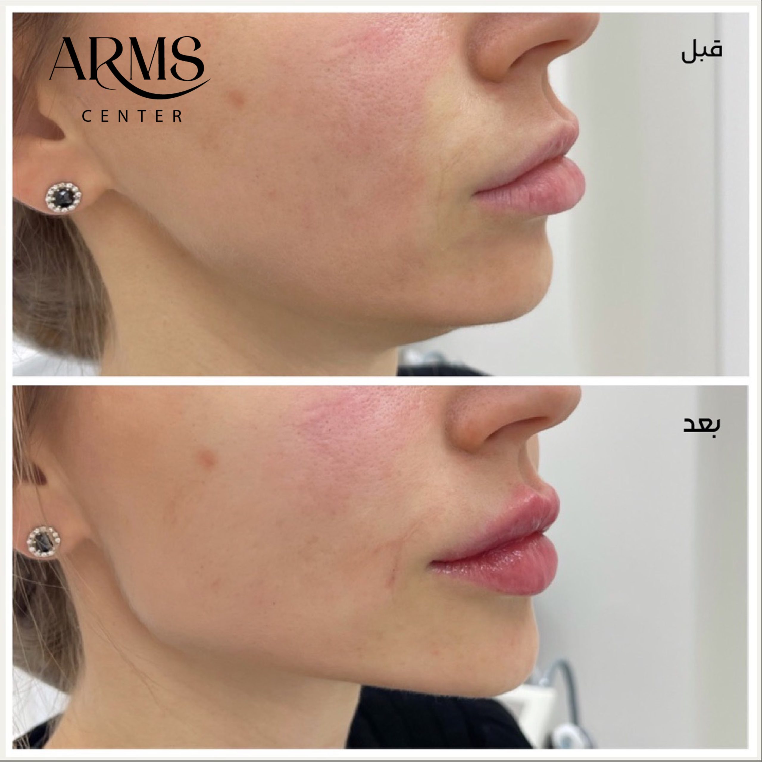 {"source_type":"vicut","tiktok_developers_3p_anchor_params":"{"source_type":"vicut","client_key":"aw889s25wozf8s7e","picture_template_id":""}","pictureId":"4774251A-0D0C-4184-A13F-4392DDC7F2C9","data":{}}