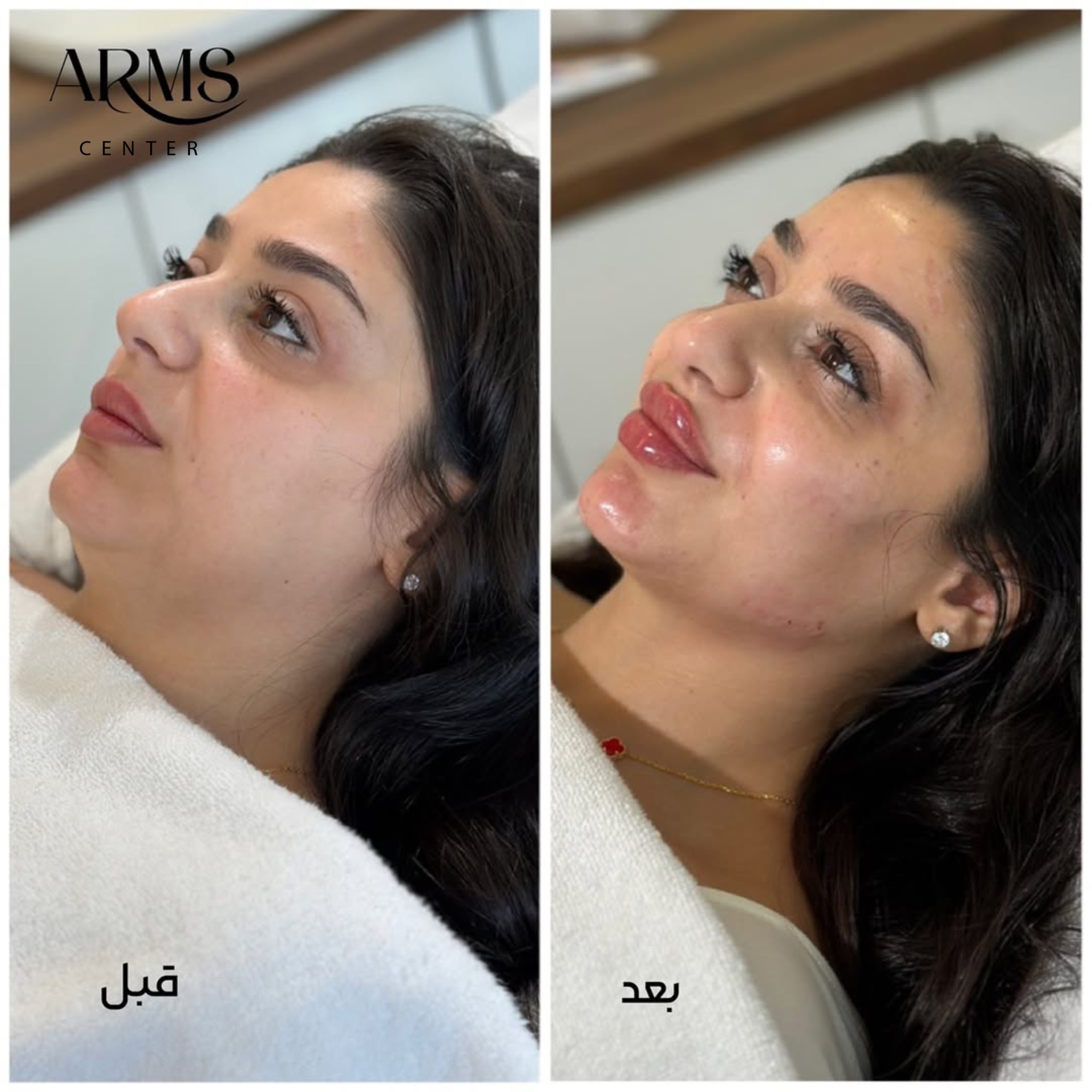 {"source_type":"vicut","pictureId":"32432E6C-8221-4137-A82F-32A135A3BDDC","tiktok_developers_3p_anchor_params":"{"source_type":"vicut","client_key":"aw889s25wozf8s7e","picture_template_id":""}","data":{}}