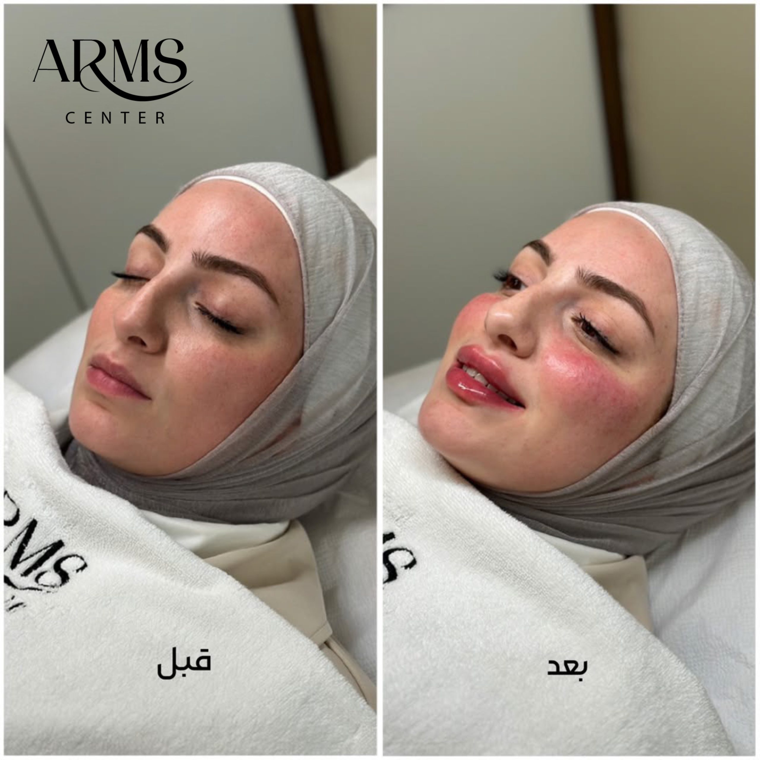 {"pictureId":"F4C9D6EC-0E11-4B71-A63C-1378D2AD8704","source_type":"vicut","tiktok_developers_3p_anchor_params":"{"picture_template_id":"","source_type":"vicut","client_key":"aw889s25wozf8s7e"}","data":{}}