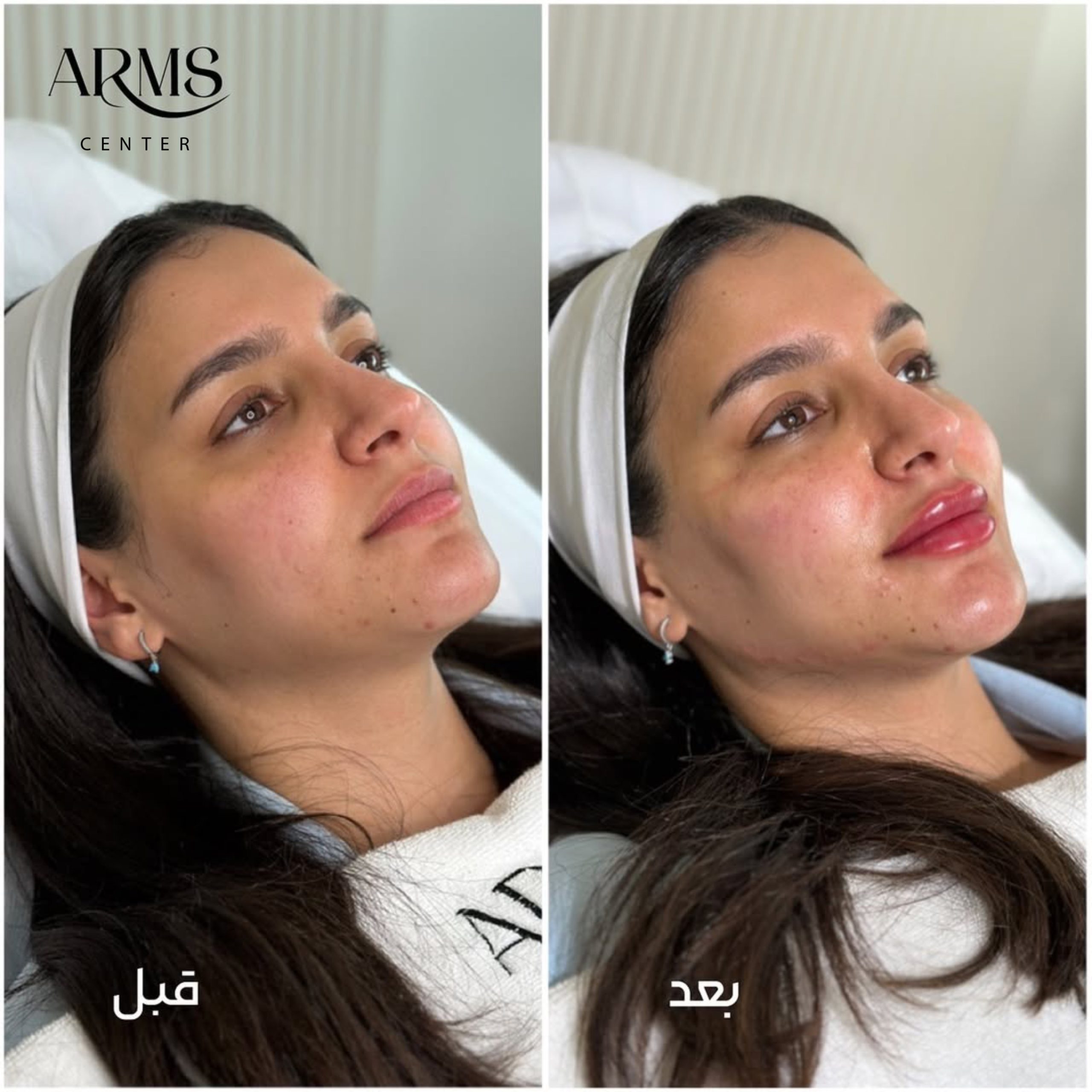 {"tiktok_developers_3p_anchor_params":"{"picture_template_id":"","client_key":"aw889s25wozf8s7e","source_type":"vicut"}","source_type":"vicut","pictureId":"14F2C4F2-1D23-43A9-9B41-FCD4A7DCA997","data":{}}